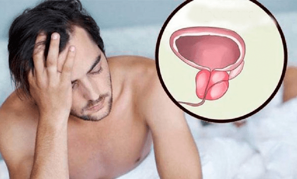 Síntomas de prostatitis